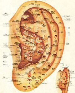 AURICULOPUNTURA